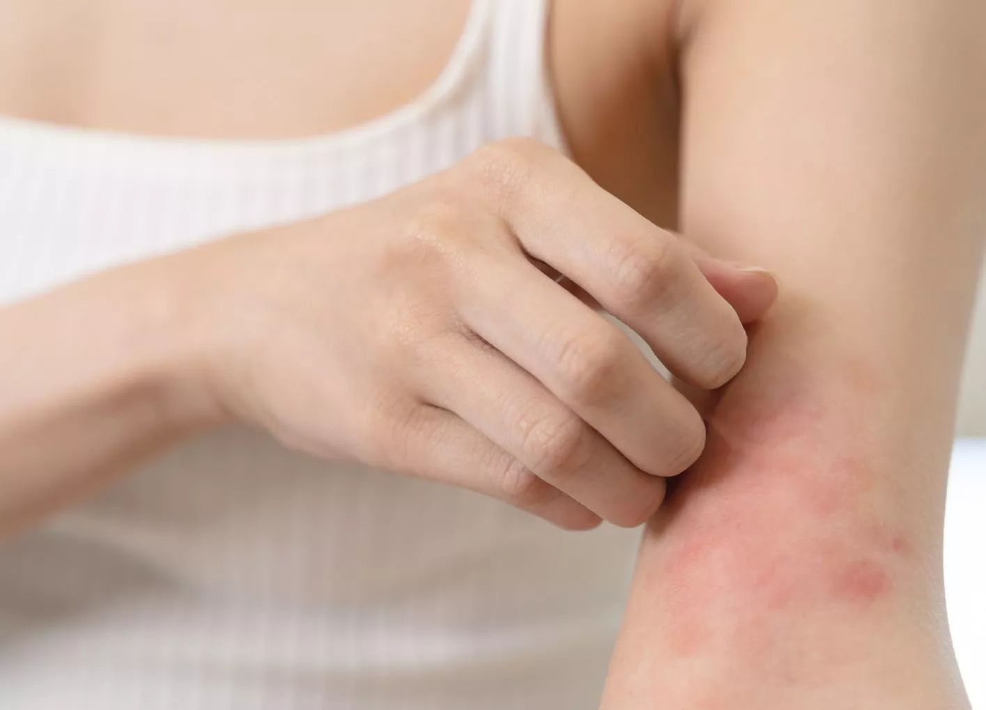 Les dermatoses visibles les plus difficiles à vivre
